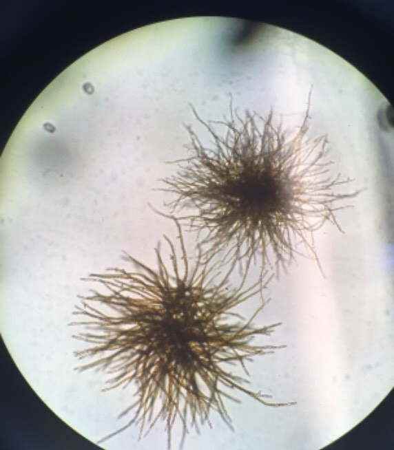 Male and female gametophytes.