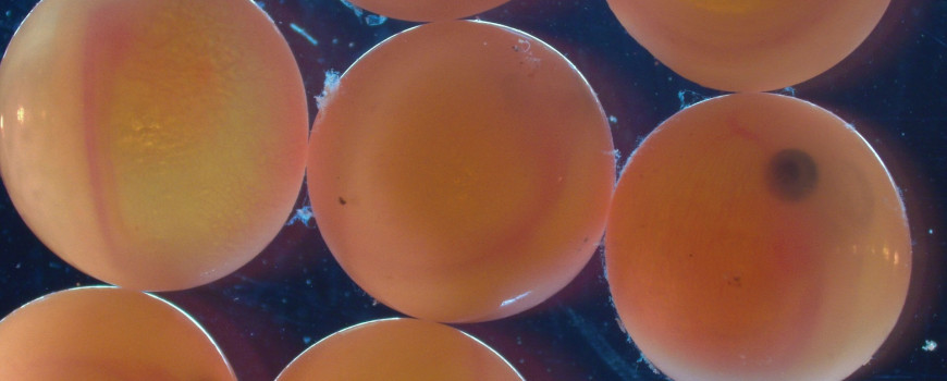 Salmon embryos under microscope.